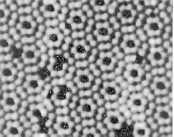 Electron microscope view of a molecular structure.
